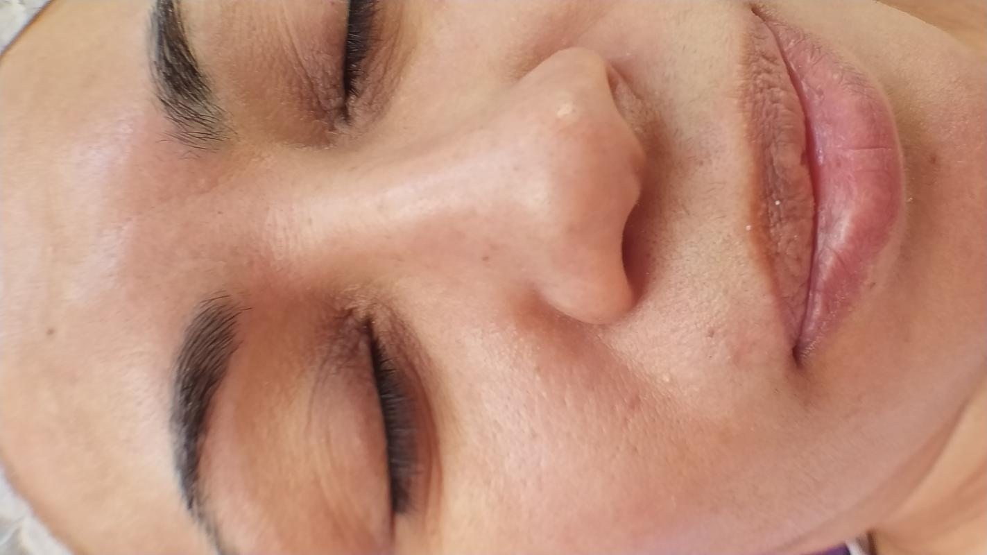 Ультразвуковая чистка лица, миндальный пилинг, массаж лица, уходовые процедуры за лицом - Орск