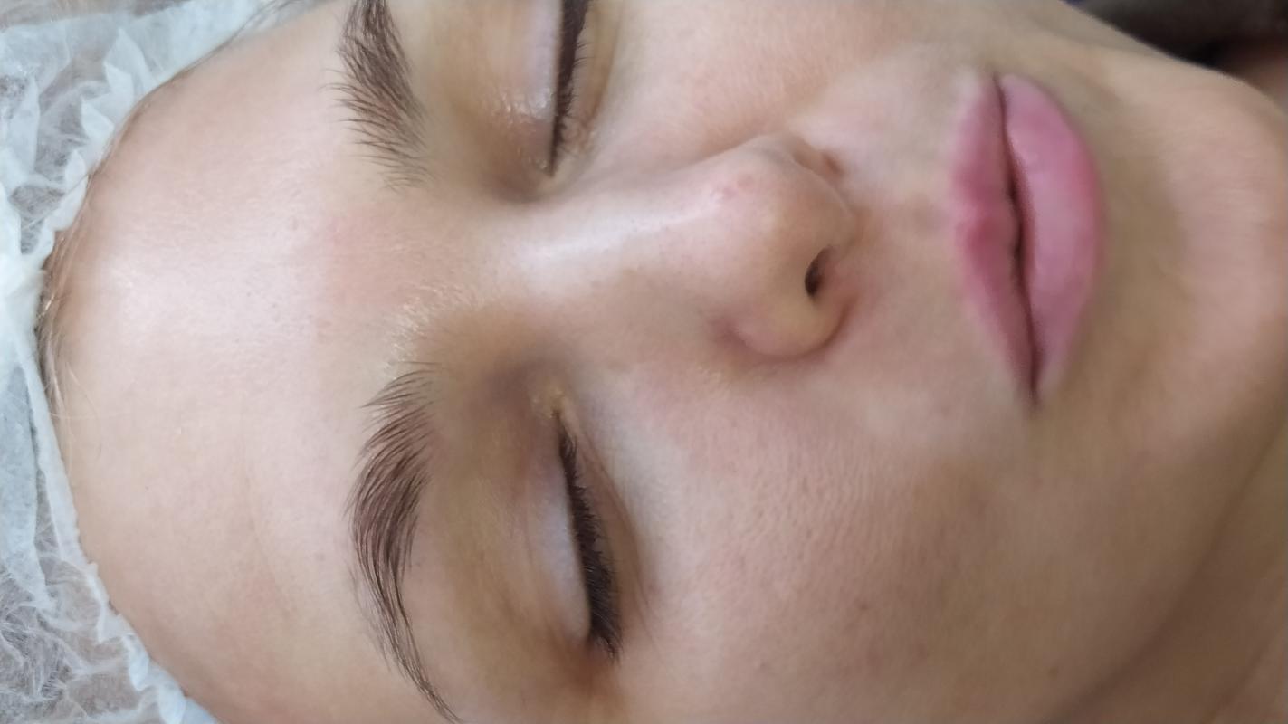 Ультразвуковая чистка лица, миндальный пилинг, массаж лица, уходовые процедуры за лицом - Орск