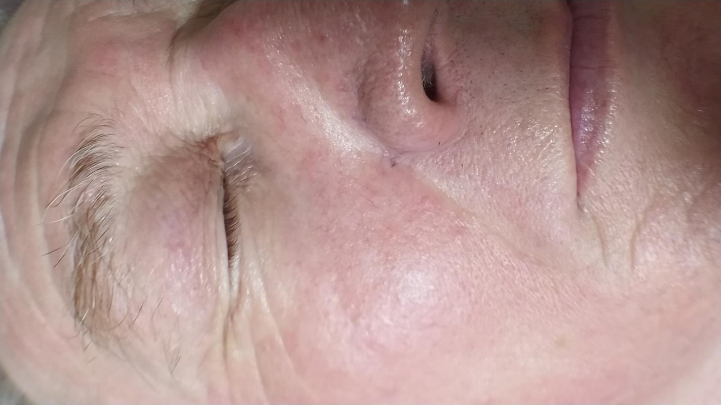 Ультразвуковая чистка лица, миндальный пилинг, массаж лица, уходовые процедуры за лицом - Орск