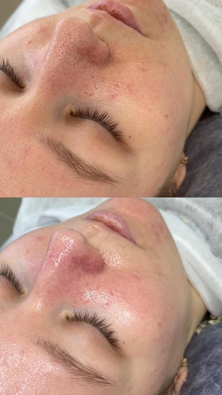 Приглашаю вас окунуться в мир красоты и здоровья! - Орск